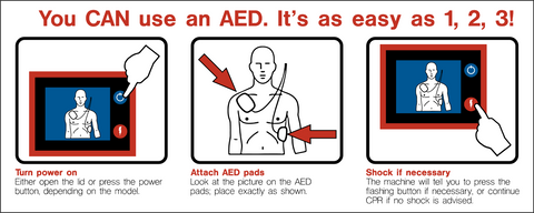 AED How to Use